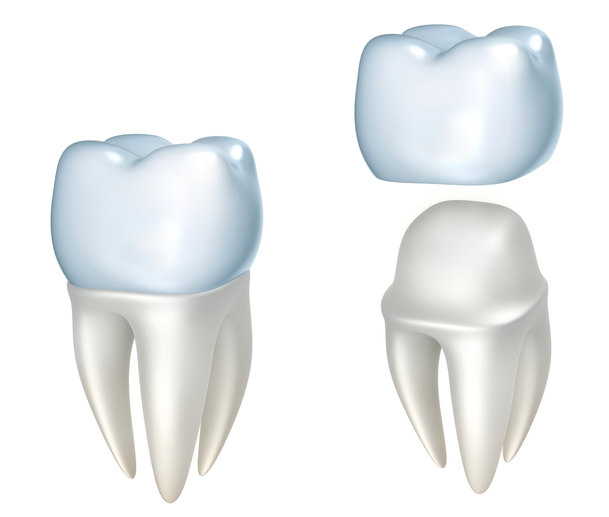 dental crown restoration Richmond VA