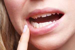 common dental issues